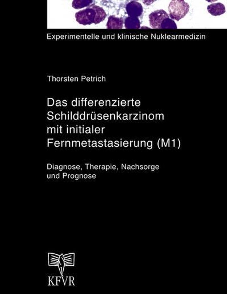 Das differenzierte Schilddrüsenkarzinom mit initialer Fernmetastasierung (M1)