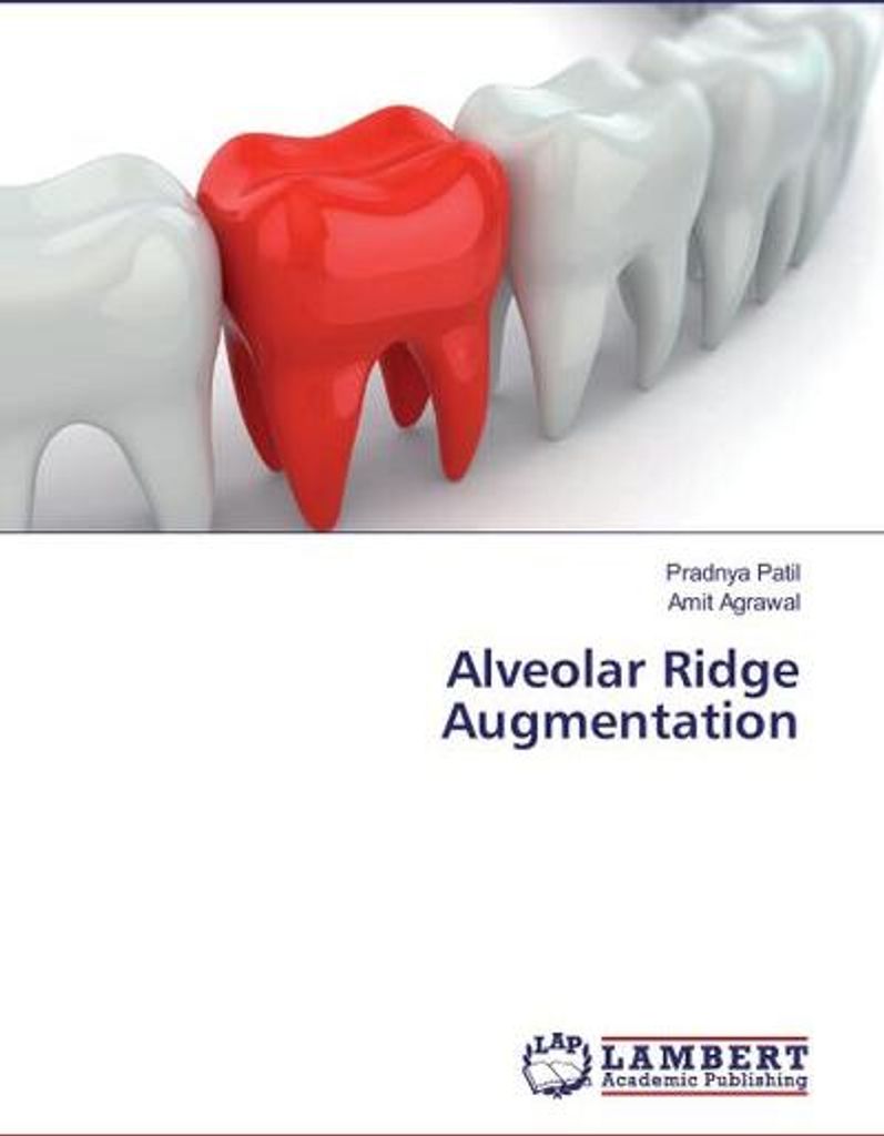 Alveolar Ridge Augmentation