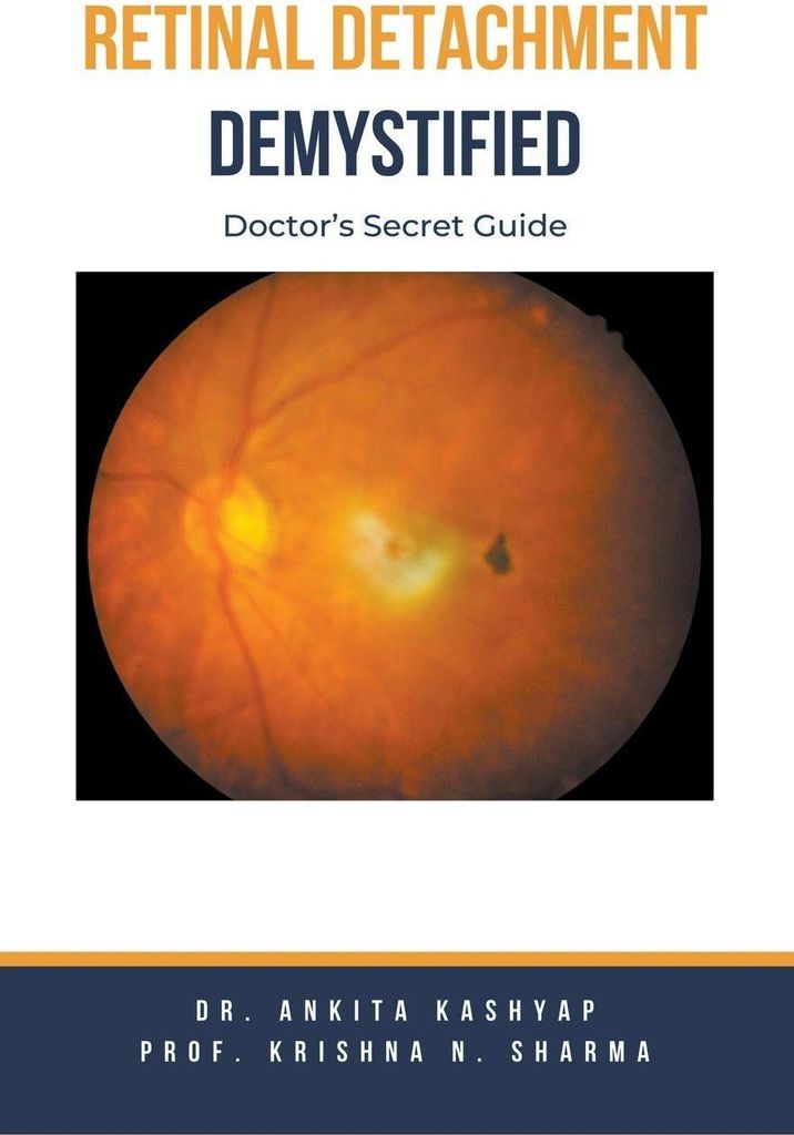 Retinal Detachment Demystified