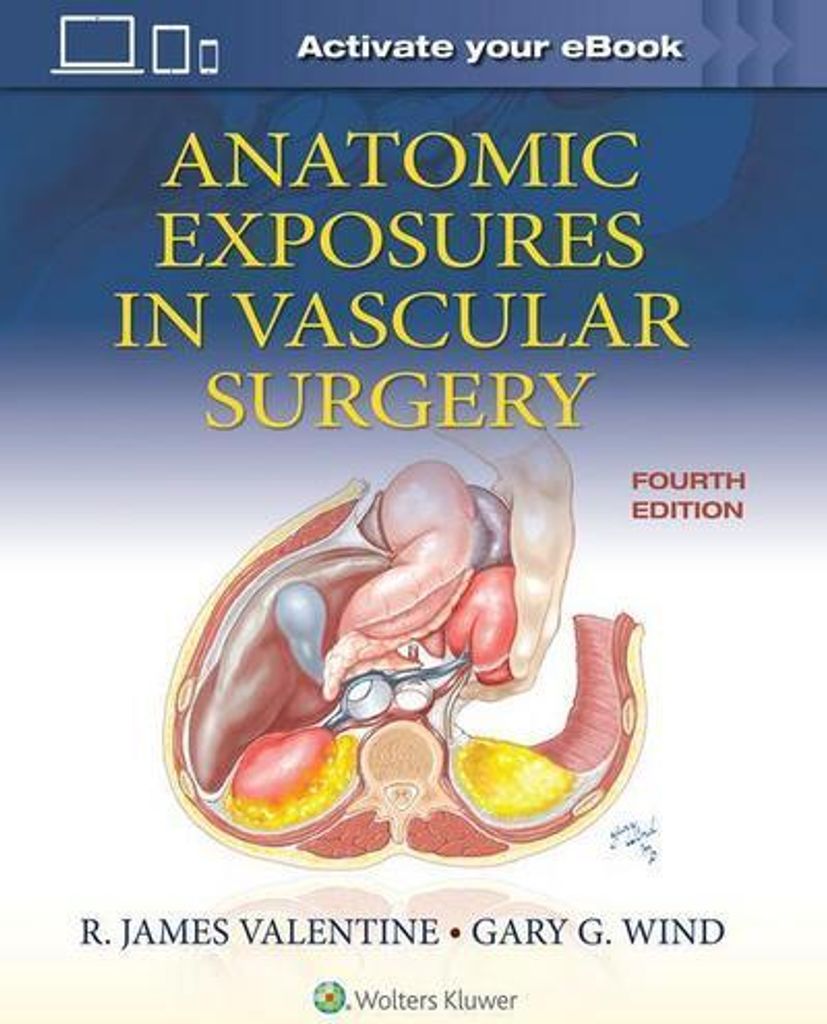 Anatomic Exposures in Vascular Surgery