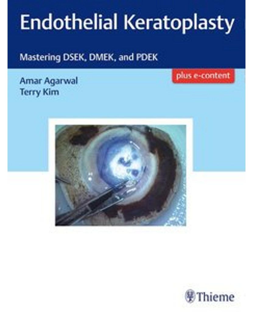 Endothelial Keratoplasty