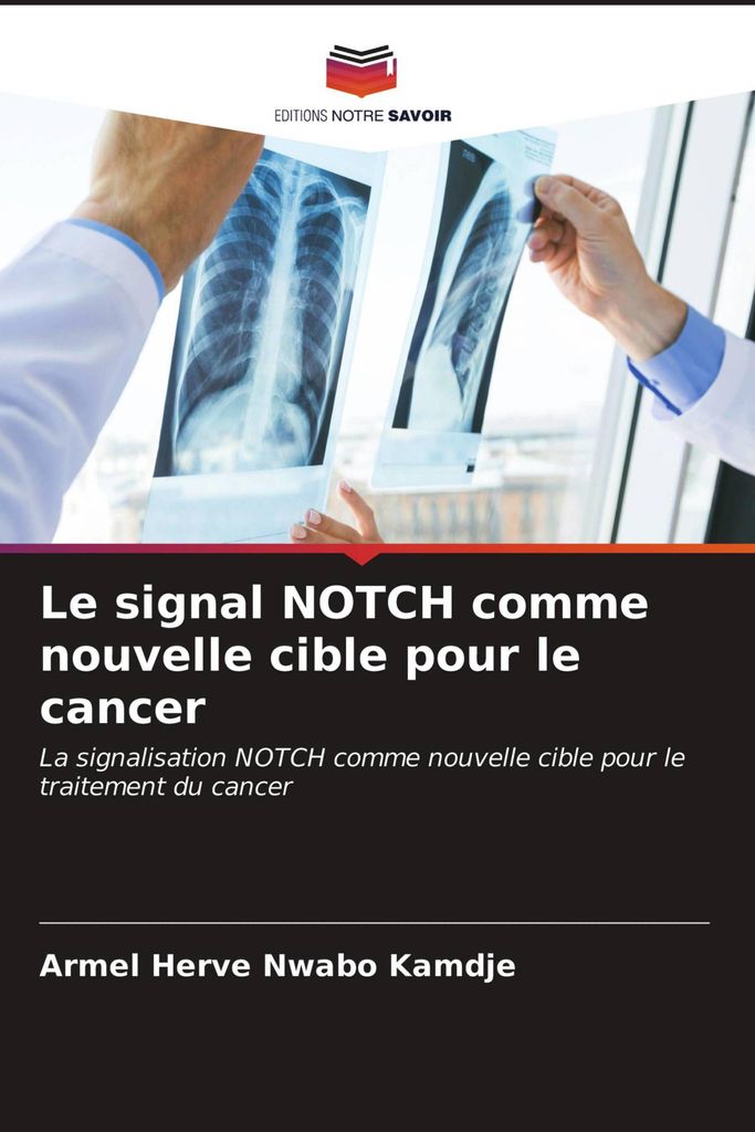 Le signal NOTCH comme nouvelle cible pour le cancer