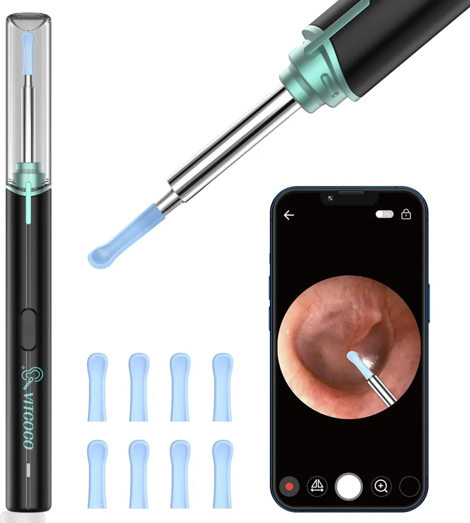 Kit d'extraction de cérumen avec caméra Wifi pour examen auditif HD