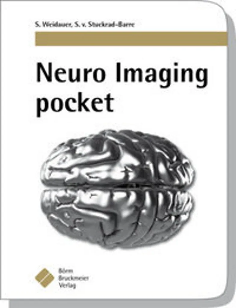 Neuro Imaging Pocket : Simplifiez l'Interprétation de vos IRM Cérébrales