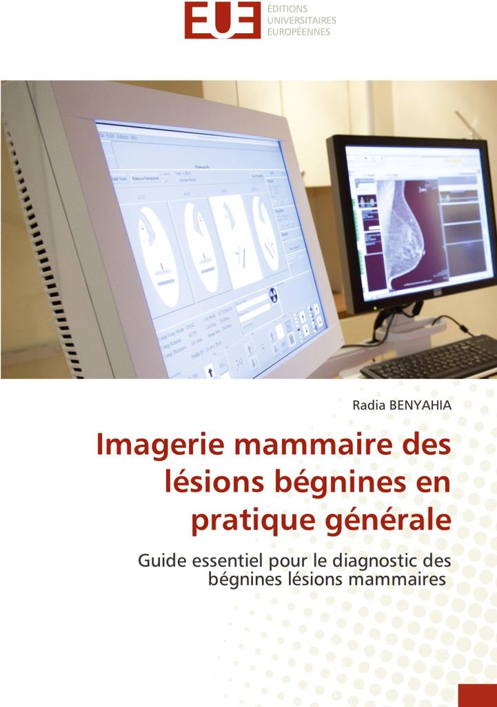 Imagerie mammaire des lésions bégnines en pratique générale