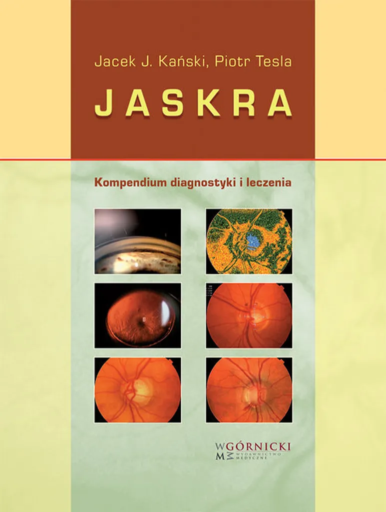 Compendium Glaucome Diagnostic et Traitement Complet Version en Polonais