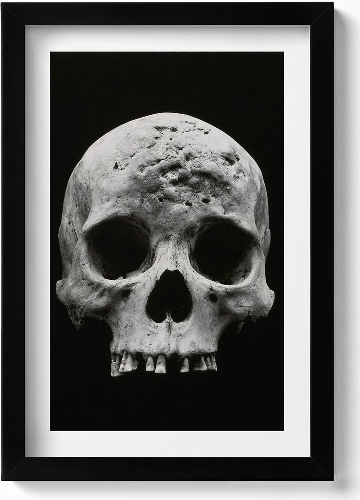 Menschliches Schädelskelett– Wandbild mit Rahmen – Gerahmtes Bild – Wanddekoration – 20x30 cm – Schwarz
