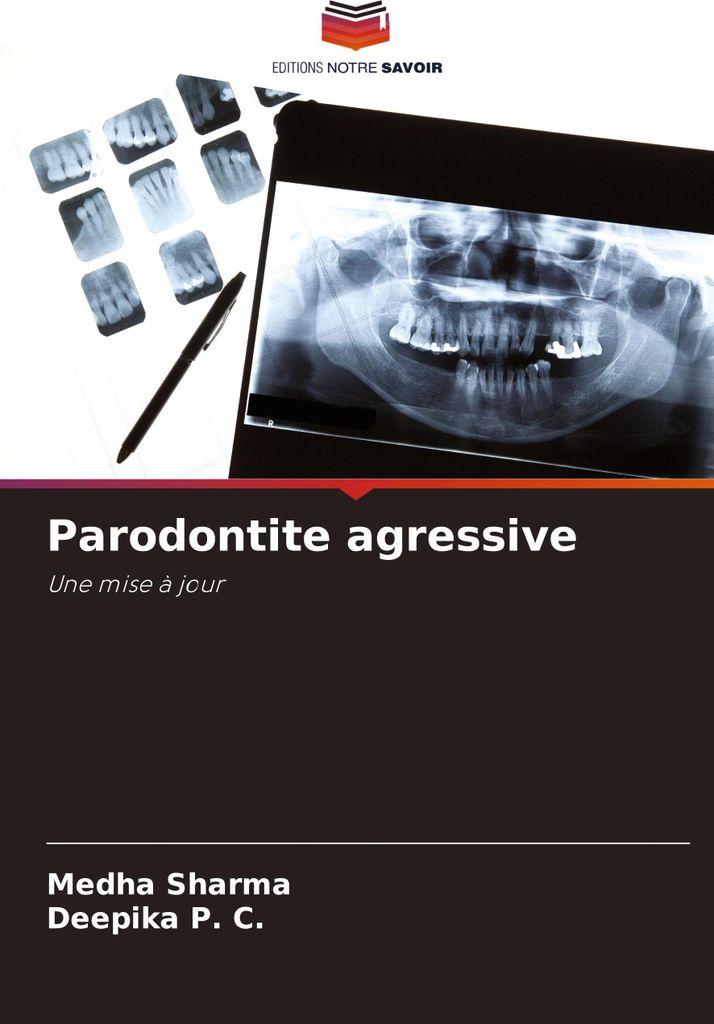 Parodontite agressive