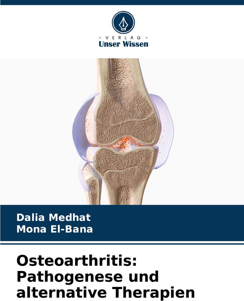 Osteoarthritis: Pathogenese und alternative Therapien