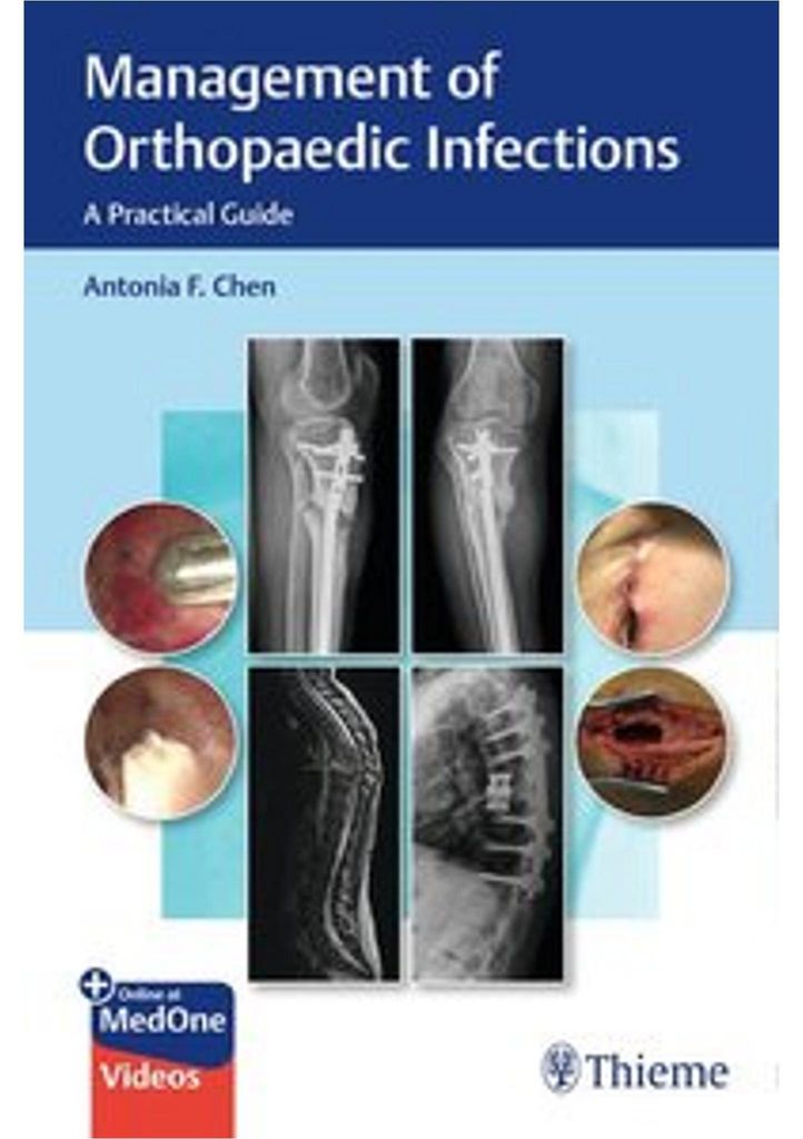 Management of Orthopaedic Infections
