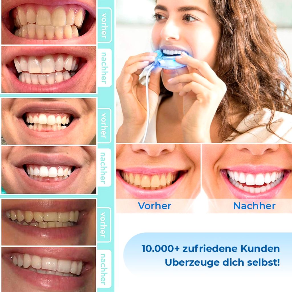 Penna Sbiancante Denti: Utilizzo E Controindicazioni - IDent Roma - Foto 11