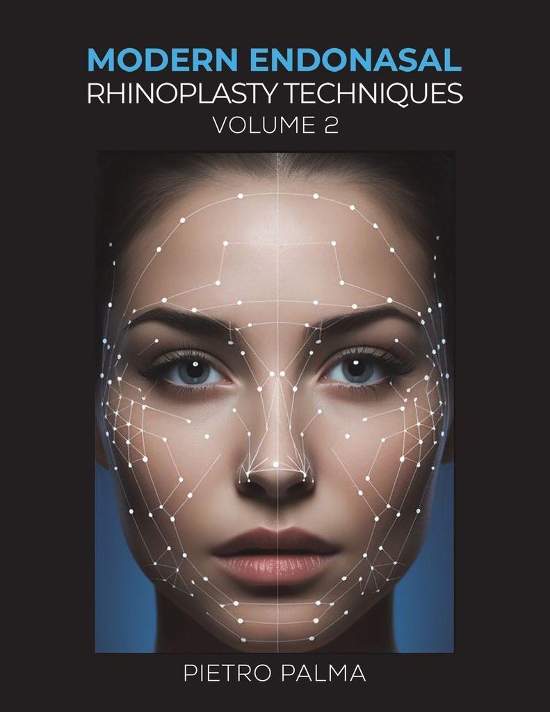 Modern Endonasal Rhinoplasty Techniques - Volume 2