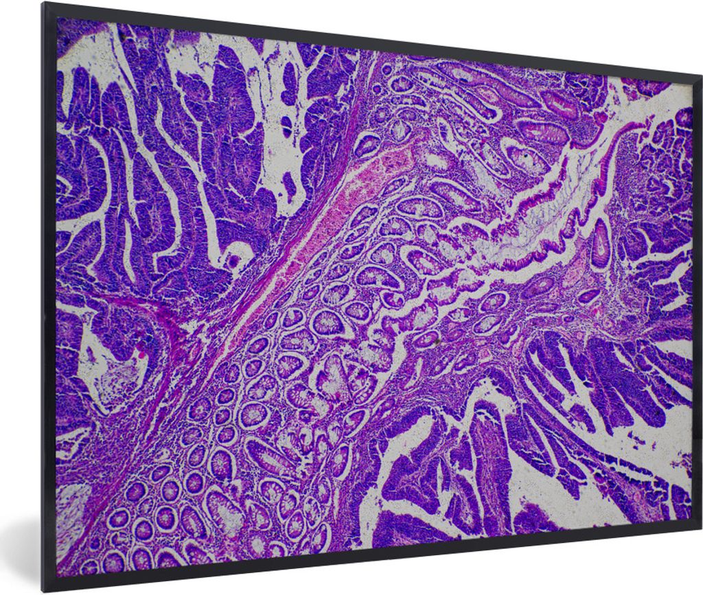 MuchoWow Gerahmtes Poster Bakterien 90x60 cm - Poster mit Schwarzem Bilderrahmen Wandposter Rahmen Foto Bilder - Fotorahmen - Foto-Plakat