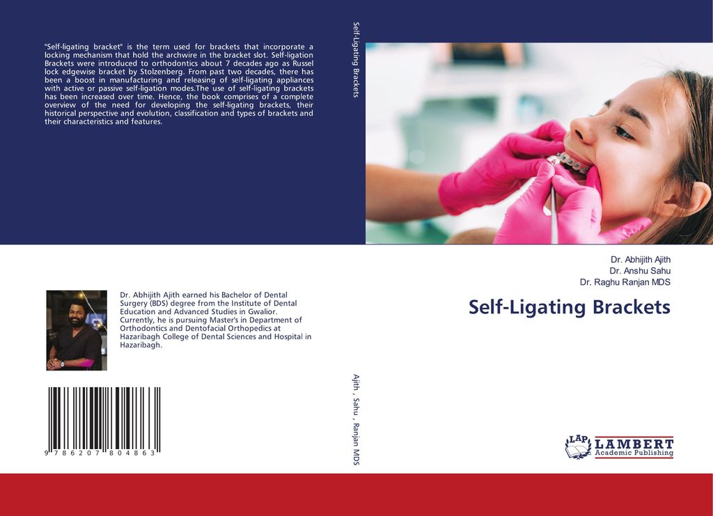 Self-Ligating Brackets