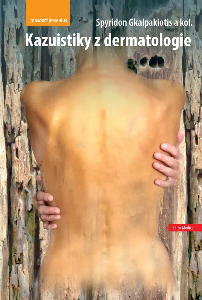 Manuel de cas cliniques Kazuistiky z dermatologie Gkalpakiotis