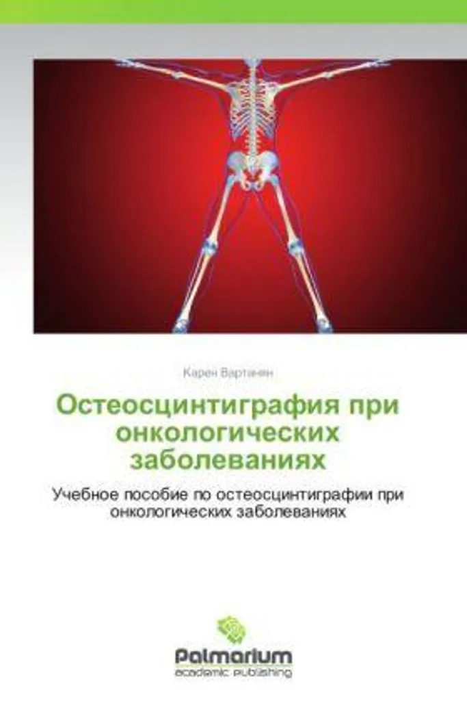 Ostéoscintigraphie et Cancer : Analyse des lésions et suivi osseux