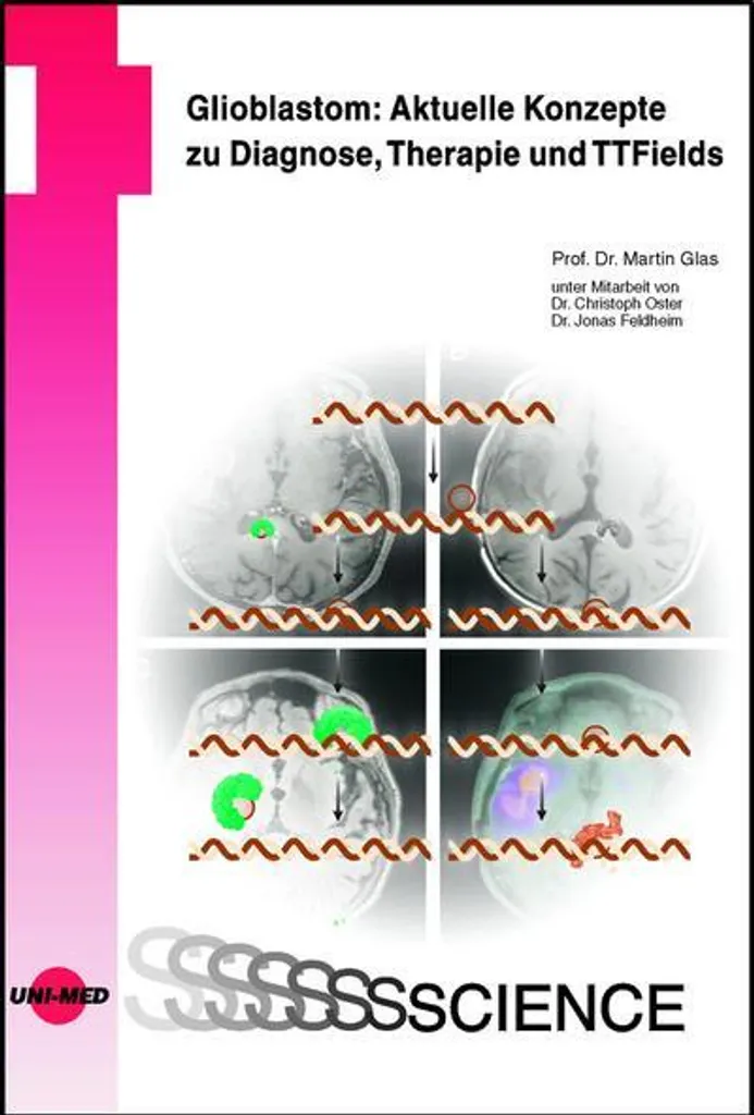 Livre Médical Glioblastome : Concepts de Diagnostic et Thérapie TTFields