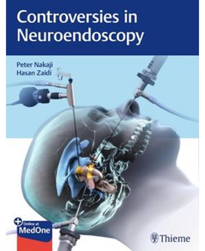 Controversies in Neuroendoscopy