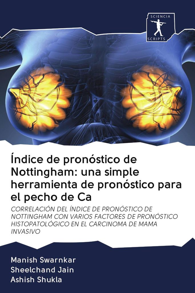 Índice de pronóstico de Nottingham: una simple herramienta de pronóstico para el pecho de Ca