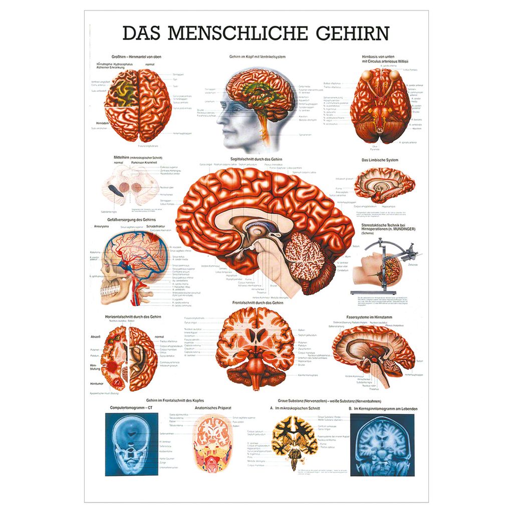 Anatomische Lehrtafel „Nervensystem Des Menschen? Produktbild-Vorschau 3