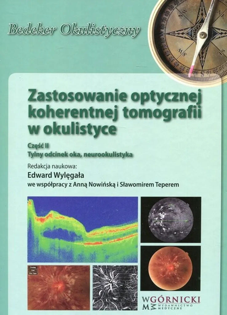 Tomographie par cohérence optique en ophtalmologie Partie 2 - Guide OCT