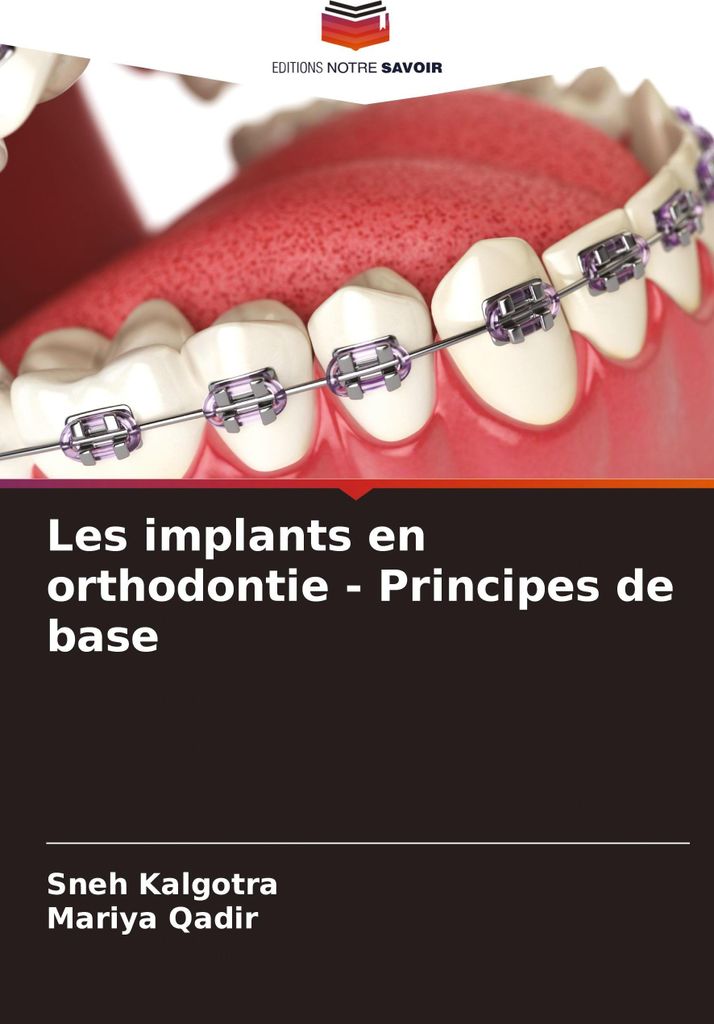 Les implants en orthodontie - Principes de base