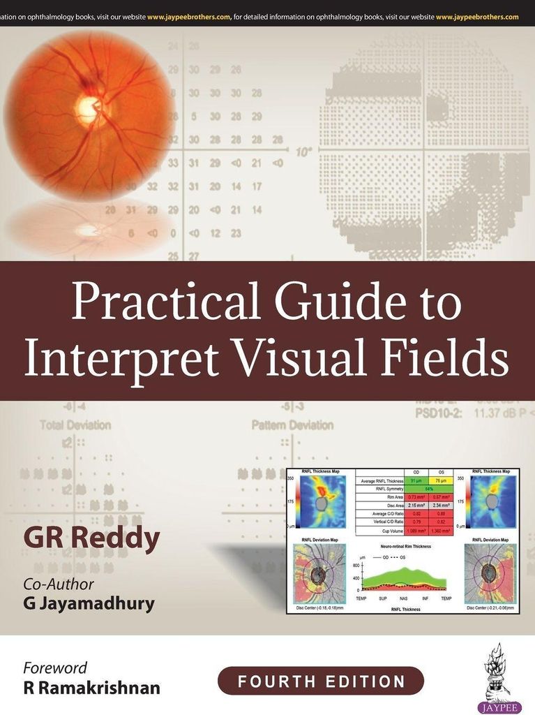 Practical Guide to Interpret Visual Fields
