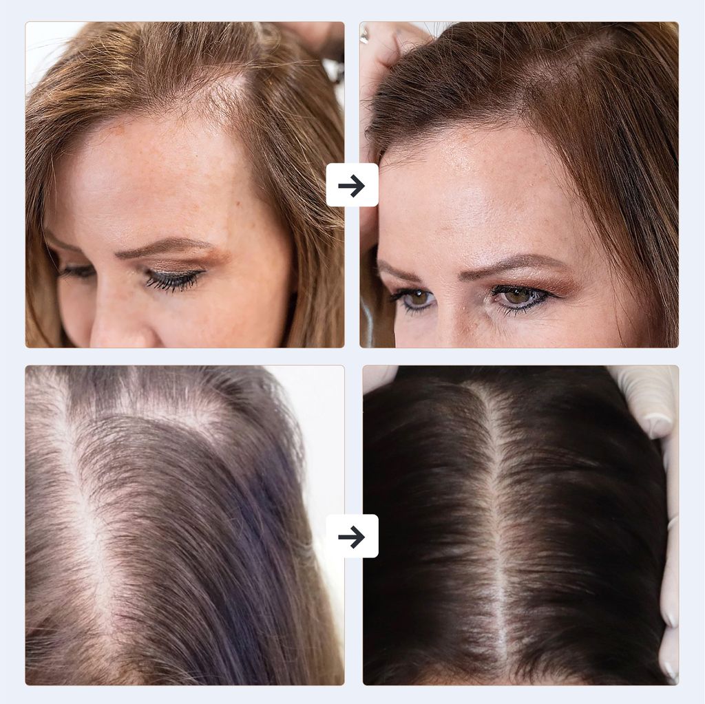 Darsonval, Hochfrequenz, Haarbehandlung, Anti-Haarausfall, Produktbild 6