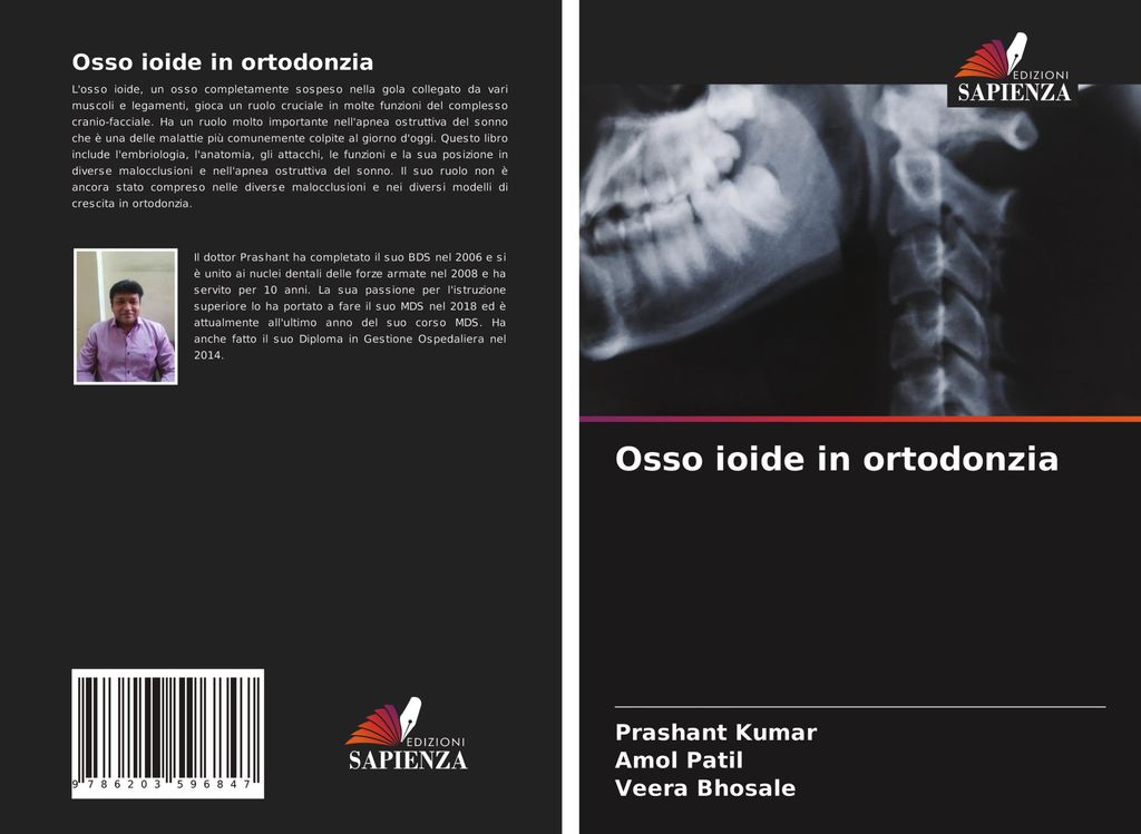 Osso ioide in ortodonzia
