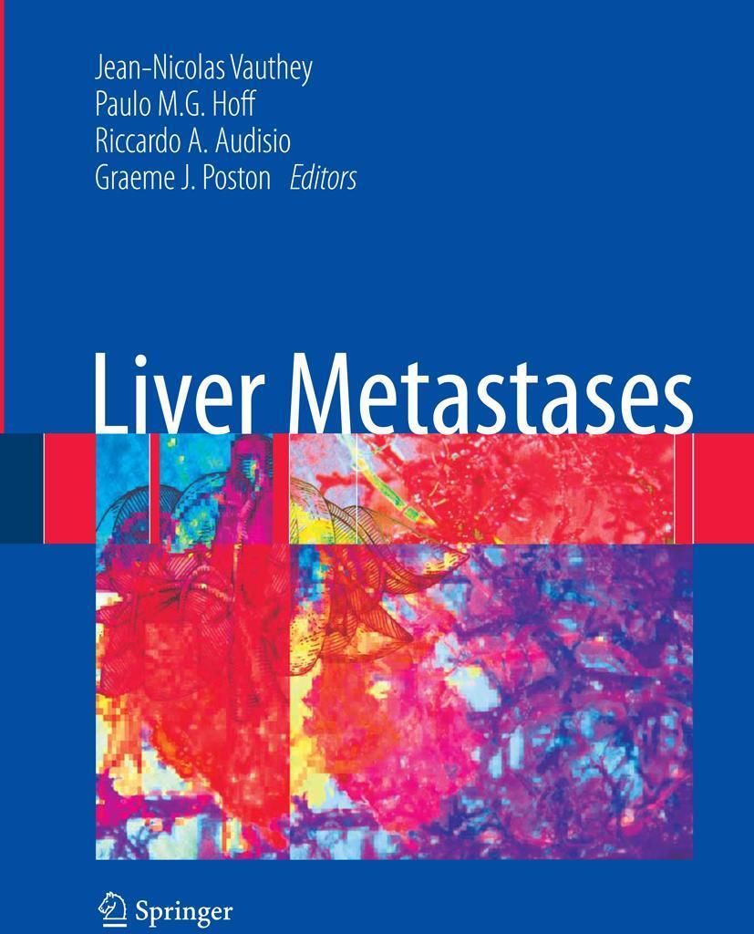 Liver Metastases