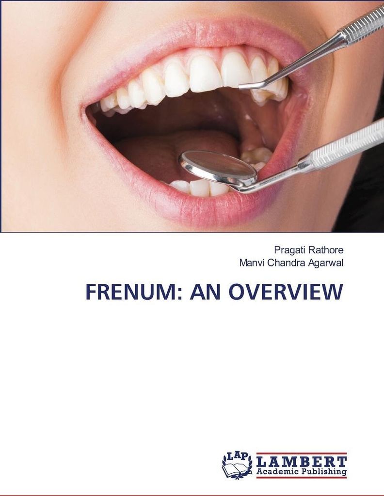 Frenum: An Overview