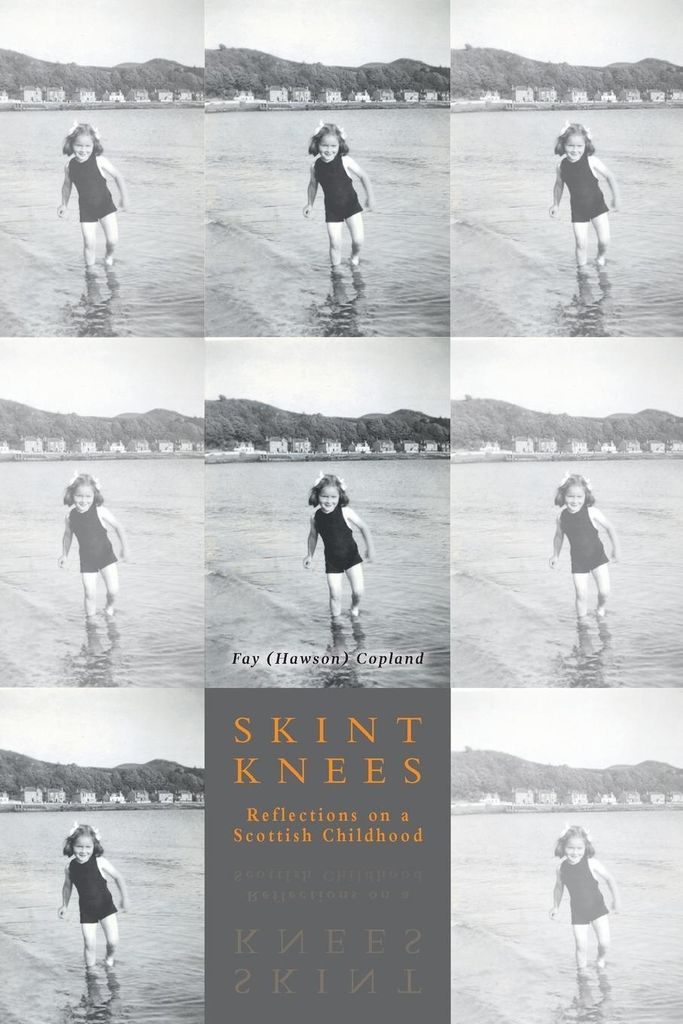 Skint Knees: Reflections on a Scottish Childhood. Copland, Fay .