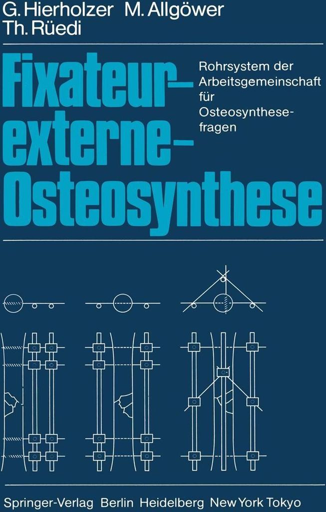 Fixateur-externe-Osteosynthese