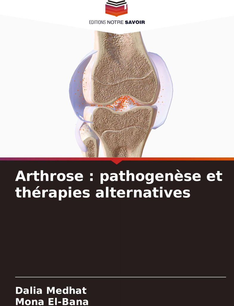 Arthrose : pathogenèse et thérapies alternatives