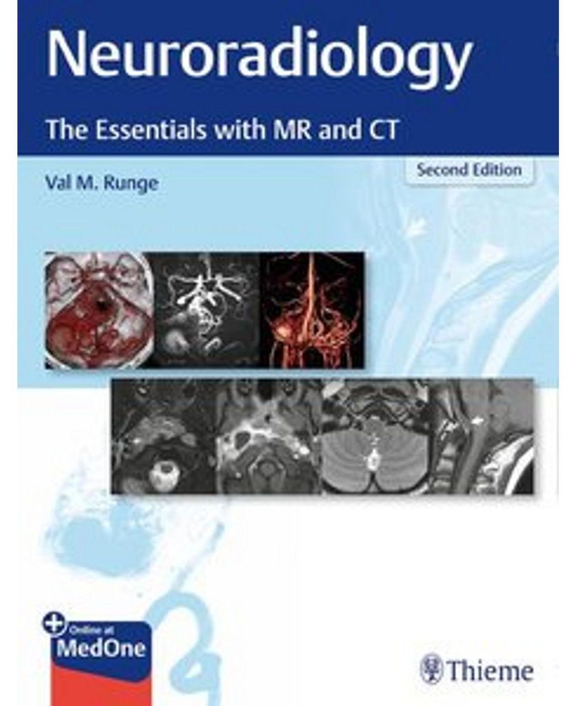 Neuroradiology