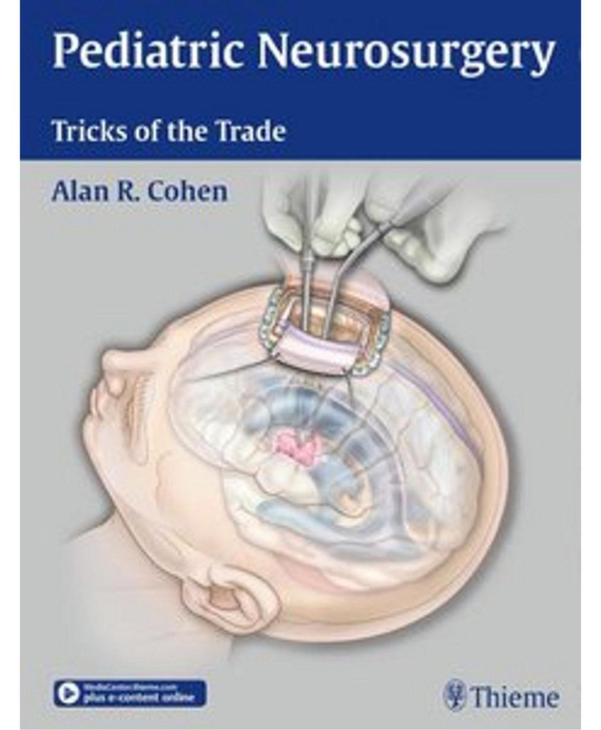 Pediatric Neurosurgery: Tricks of the Trade