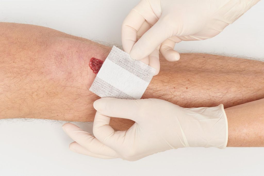 miro-plast Wundschnellverband mit Wundkompresse (Pflaster), Größe:5m x 4cm