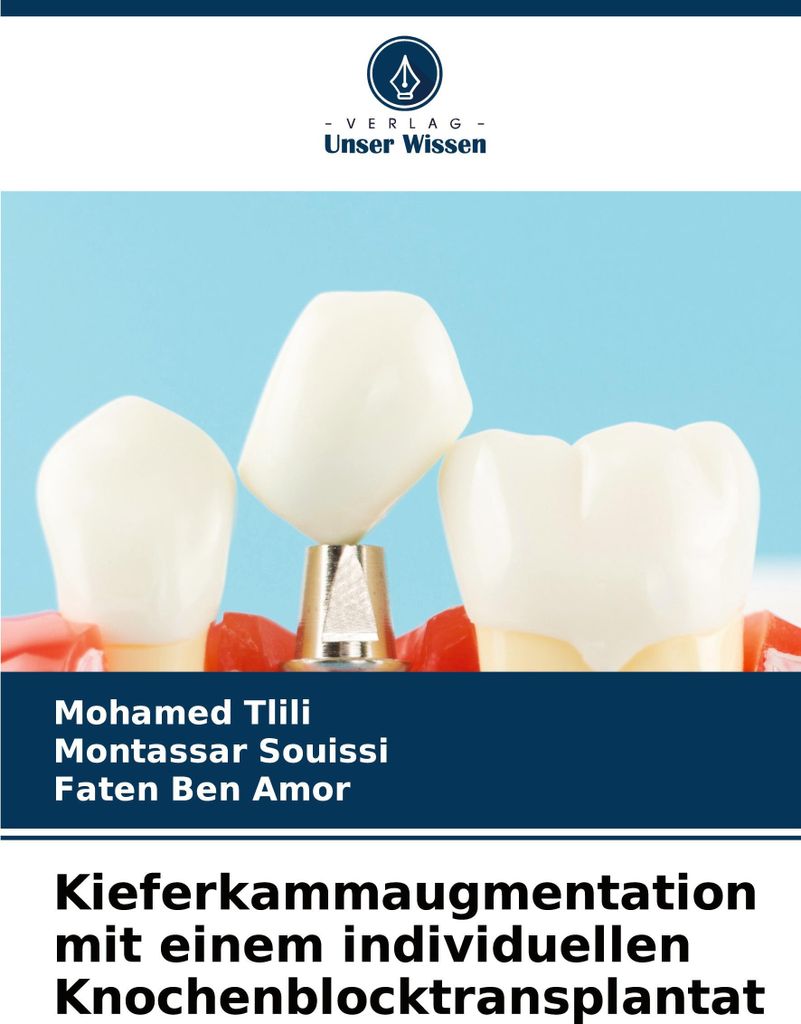 Kieferkammaugmentation mit einem individuellen Knochenblocktransplantat