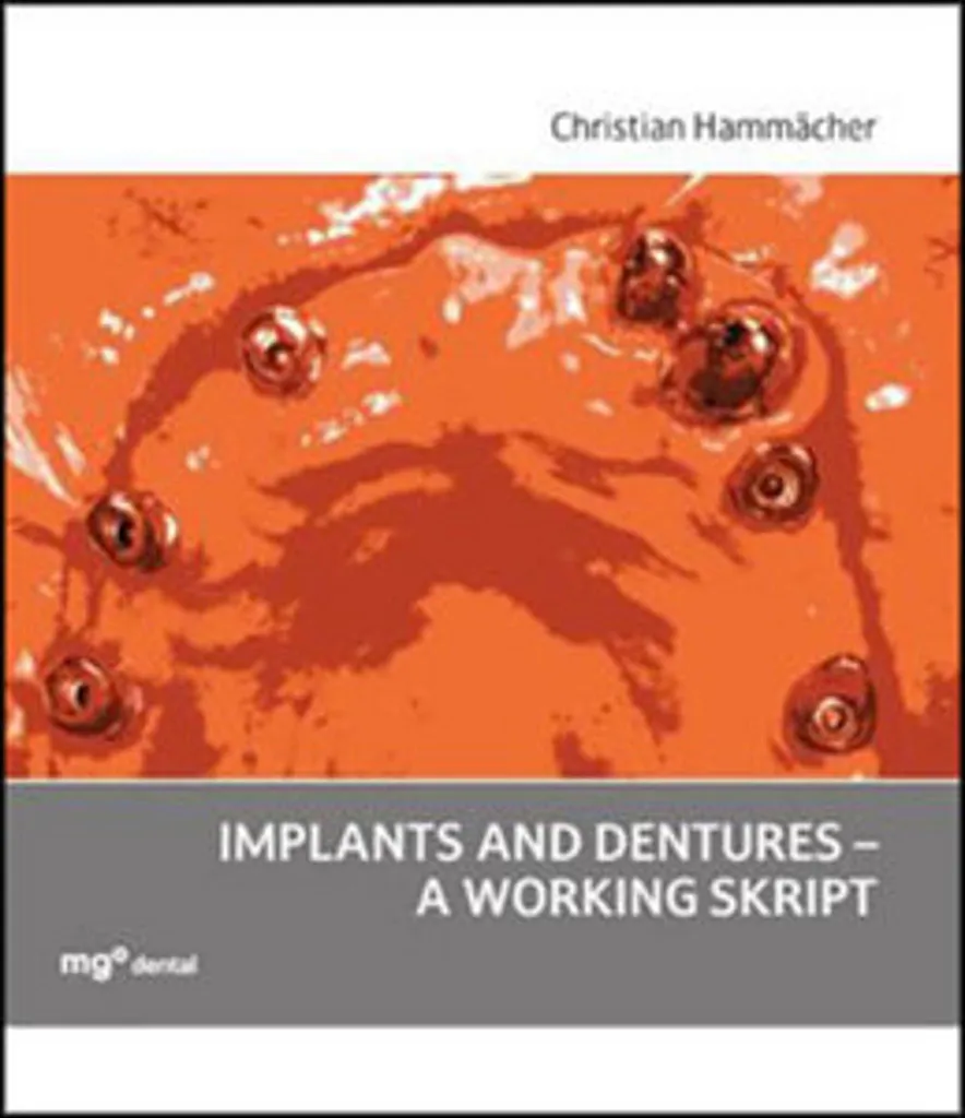 Implants et prothèses dentaires : le script de travail complet en PDF