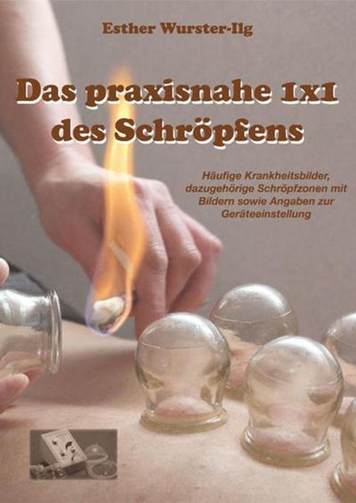 Wurster-Ilg, E: Das praxisnahe 1 x 1 des Schröpfens