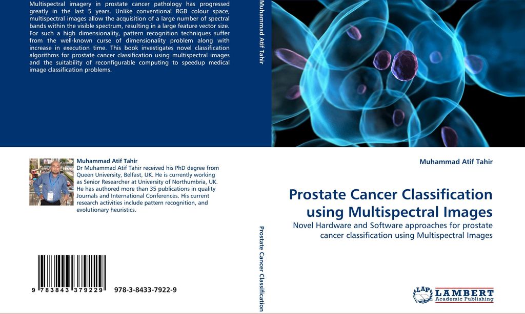 Prostate Cancer Classification using Multispectral Images