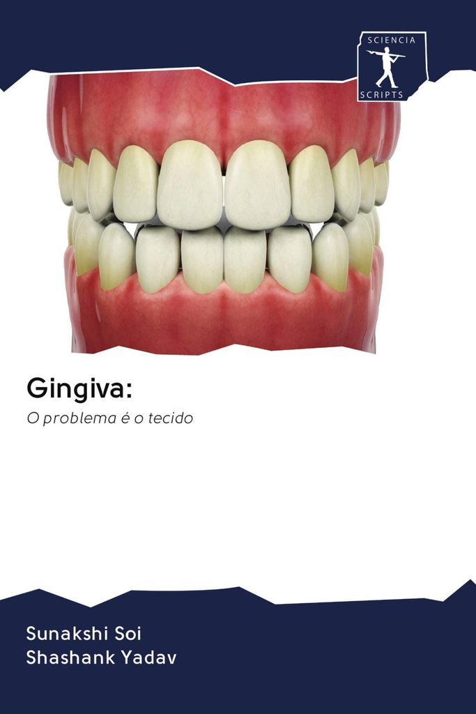 Gingiva: