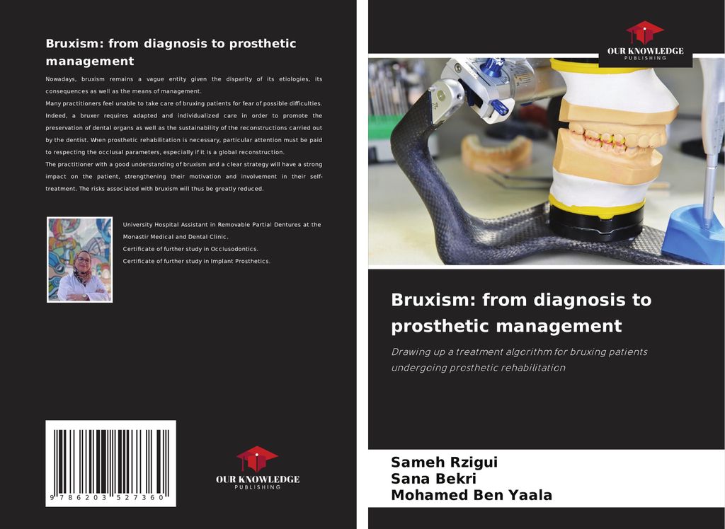 Bruxism: from diagnosis to prosthetic management