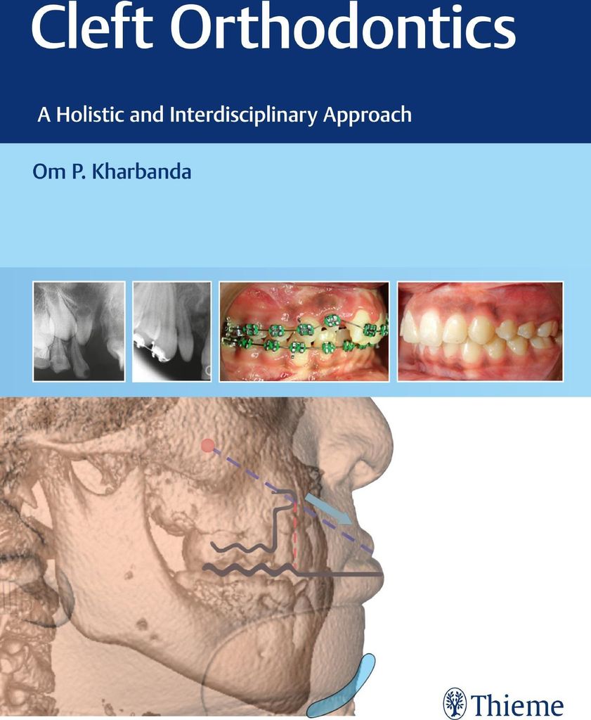 Cleft Orthodontics