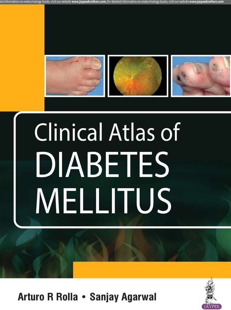Clinical Atlas of Diabetes Mellitus