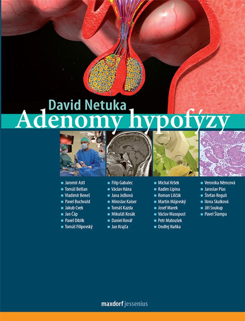 Adenomy hypofýzy (Netuka David)