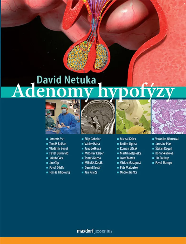 Adenomy hypofýzy par David Netuka : Ouvrage Médical sur l'Adénome Hypophysaire