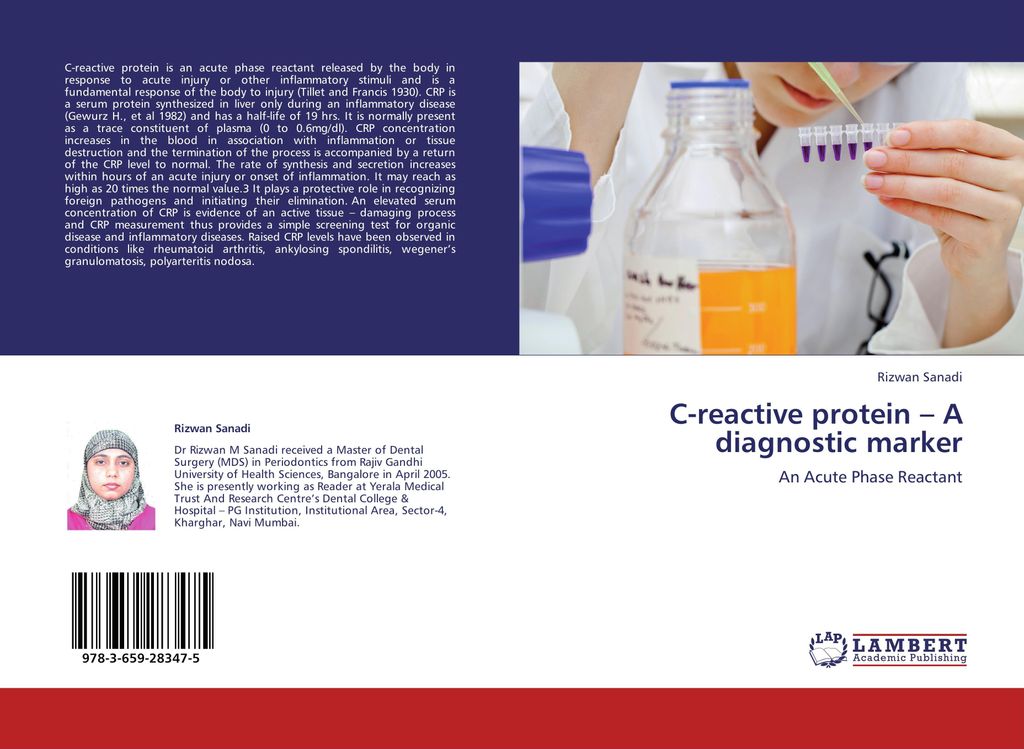 C-reactive protein - A diagnostic marker