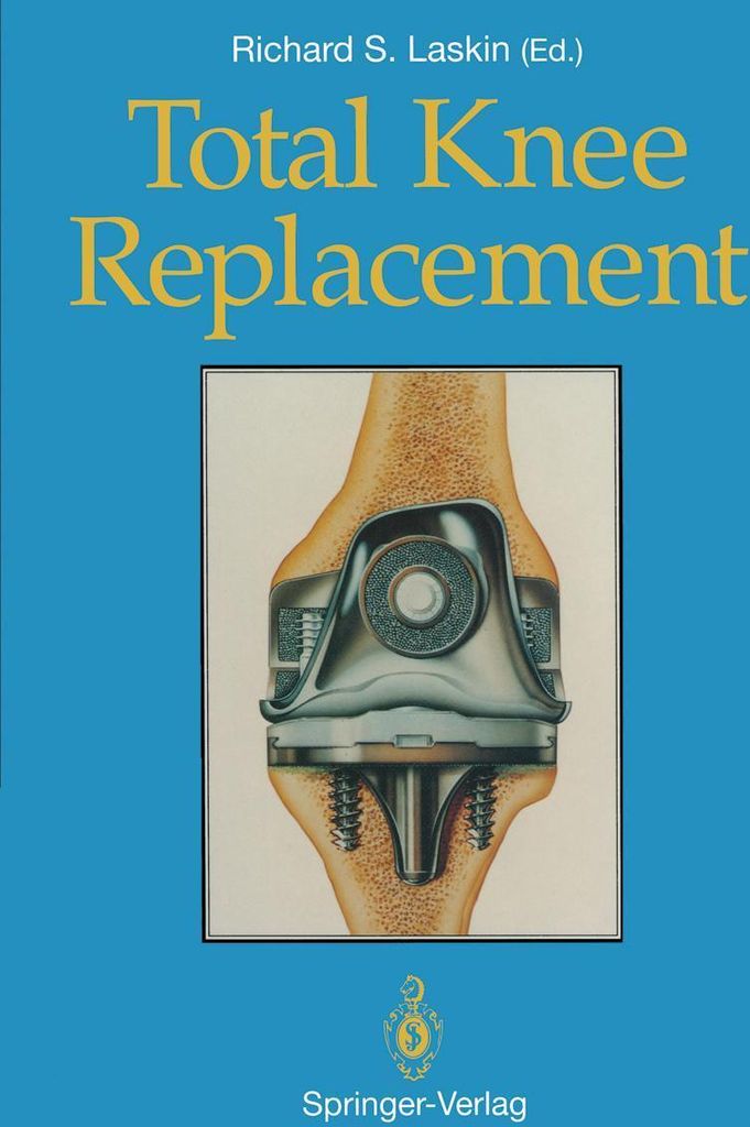 Total Knee Replacement