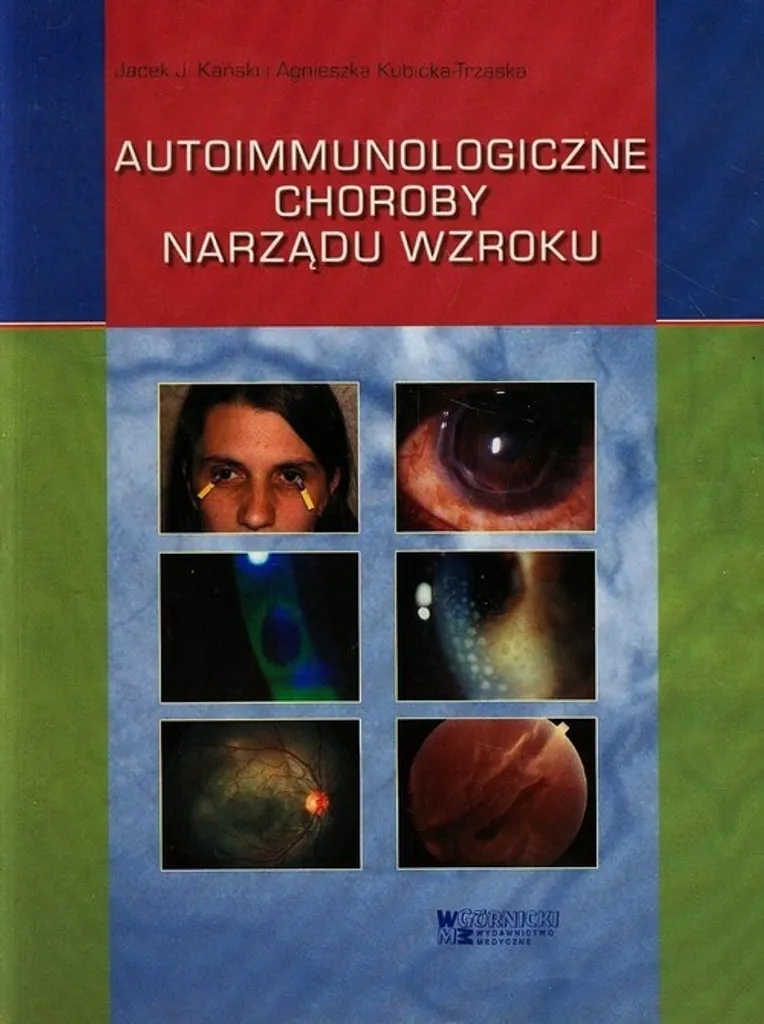 Soigner les maladies auto-immunes de l'œil : Guide de prise en charge